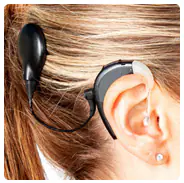 cochlear implant